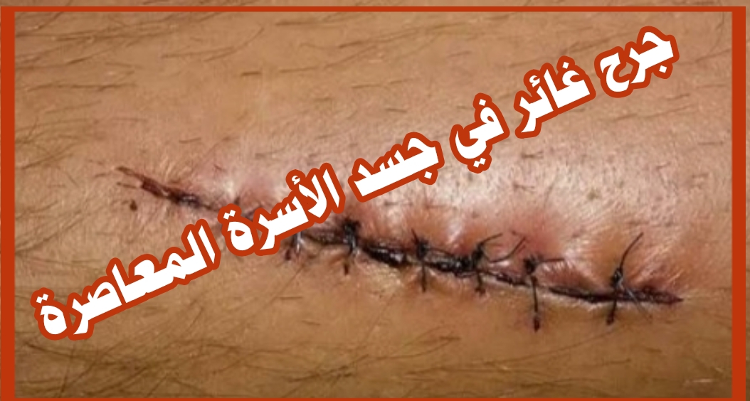 ((جرح غائر في جسد الأسرة المعاصرة ))